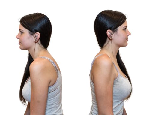 The Real Fix for Slouching Shoulder- Beyond Adjustments